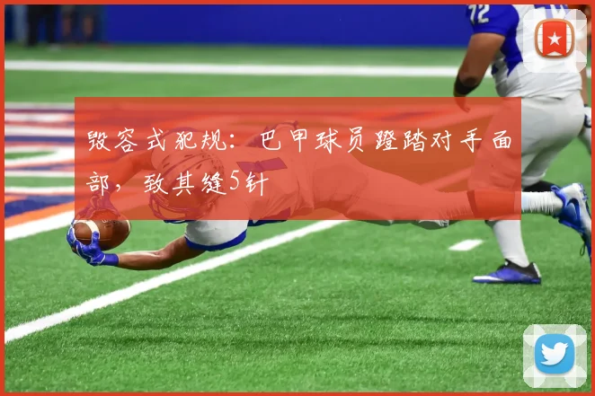 毁容式犯规：巴甲球员蹬踏对手面部，致其缝5针